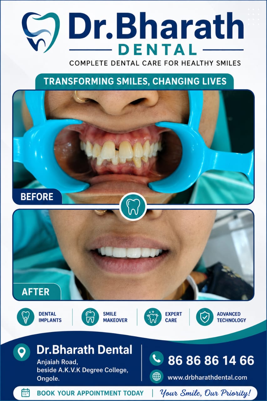 Smile Makeover Before and After